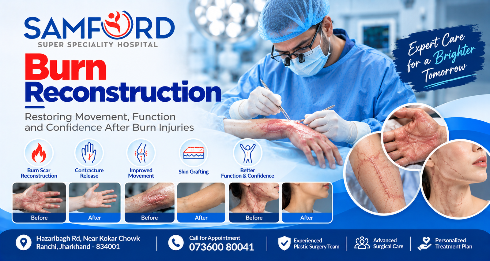 Burn Reconstruction