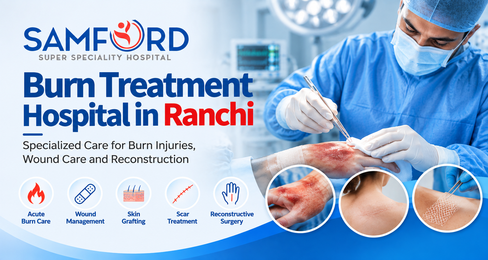 Burn Treatment Hospital in Ranchi
