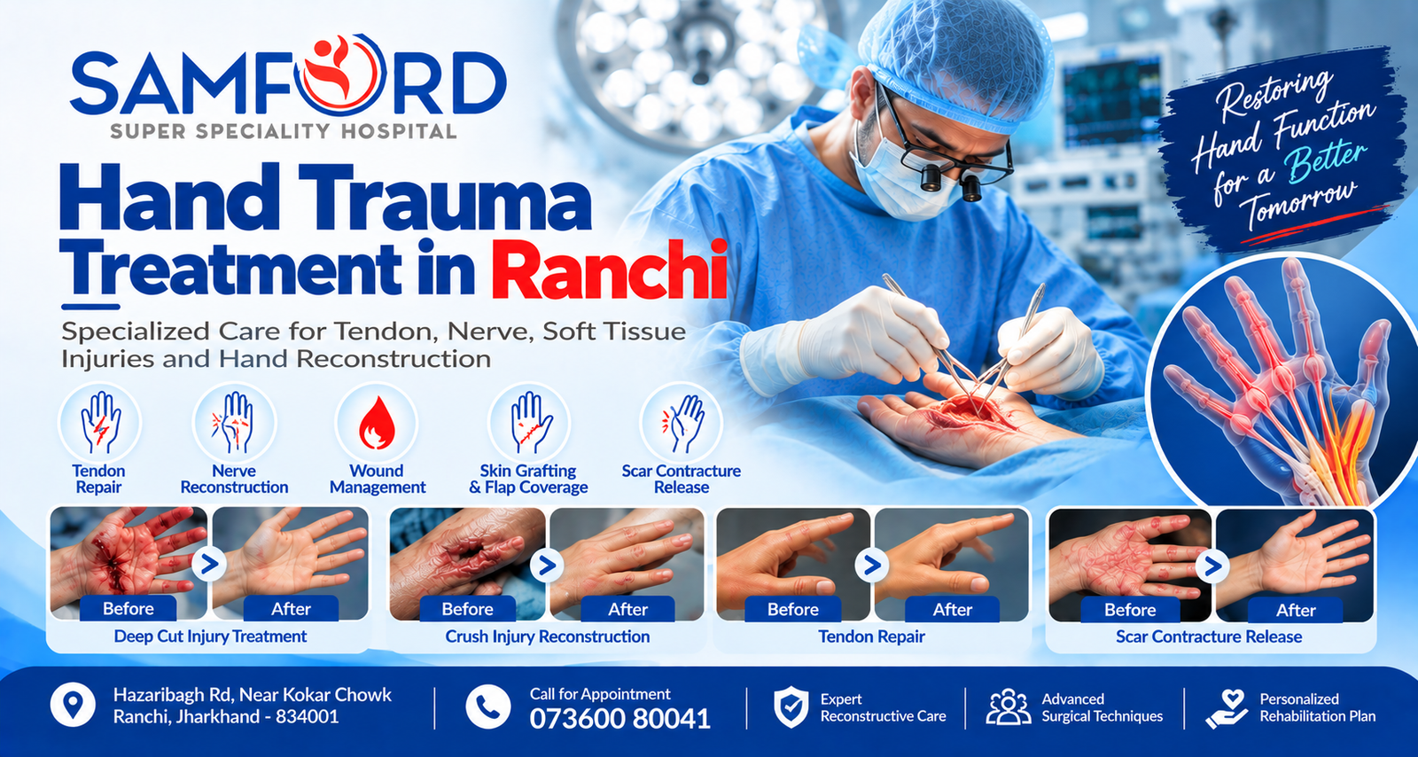 Hand Trauma Treatment in Ranchi