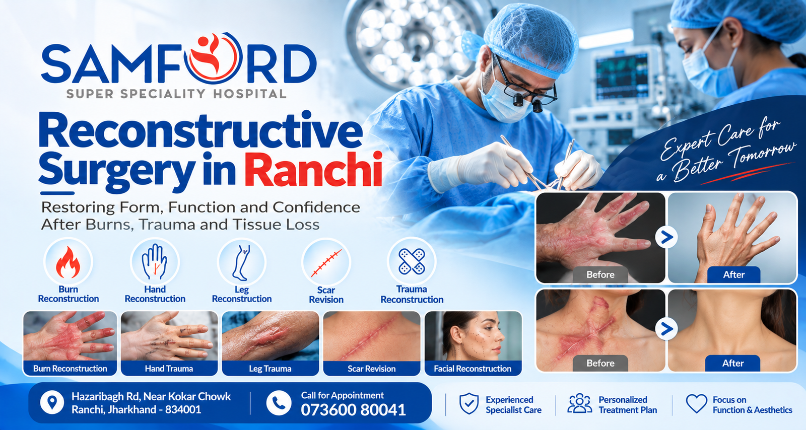 Reconstructive Surgery in Ranchi
