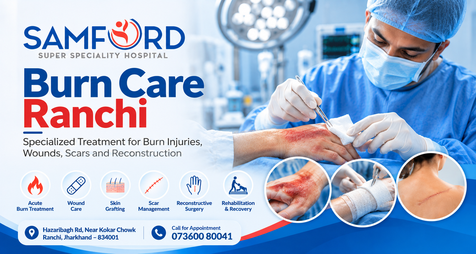 Burn Care Ranchi