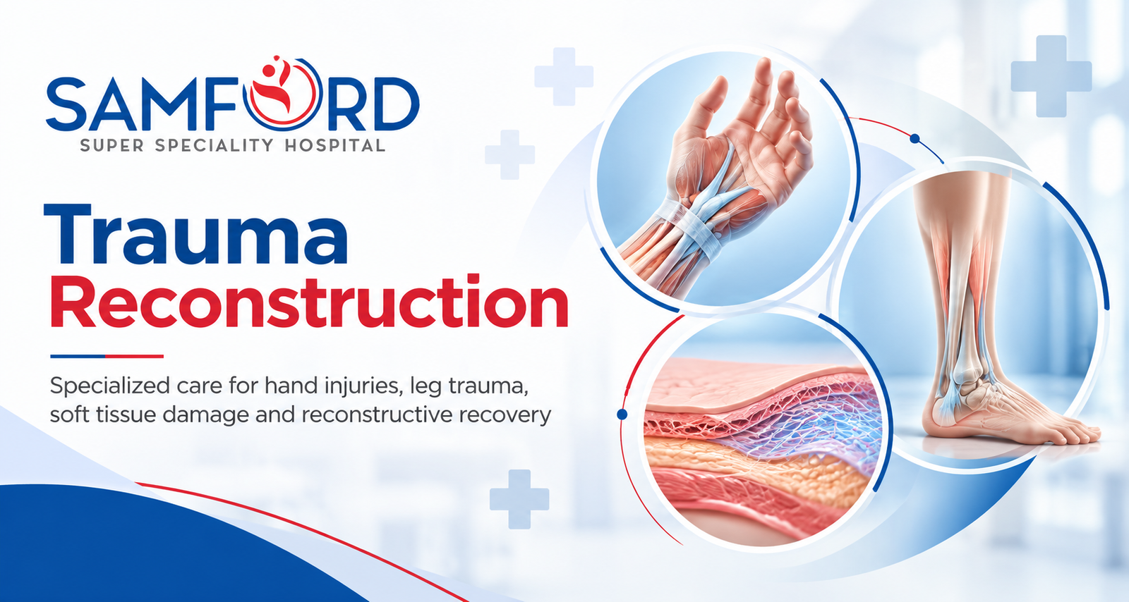 Trauma Reconstruction
